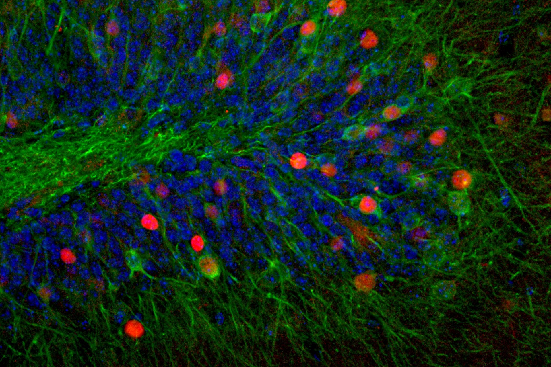 Fluorescence microscopy cross section of a rodent hippocampus, with neurons active during memory recall labeled in green